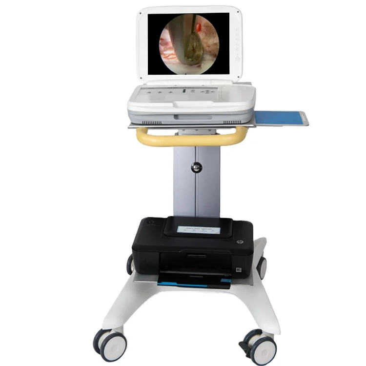 Sistema de endoscopio portátil - Medical Lab Images reseña y precio