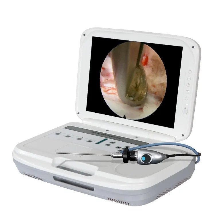 Sistema de endoscopio portátil - Medical Lab Images reseña y precio